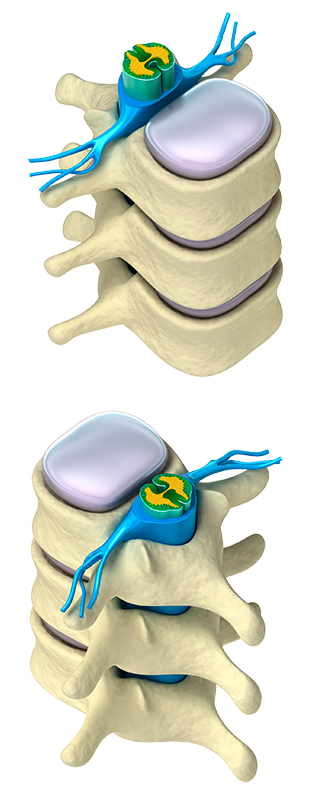 VertebralDISC