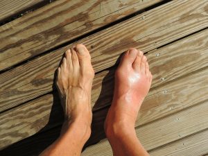 feet-174216_1920